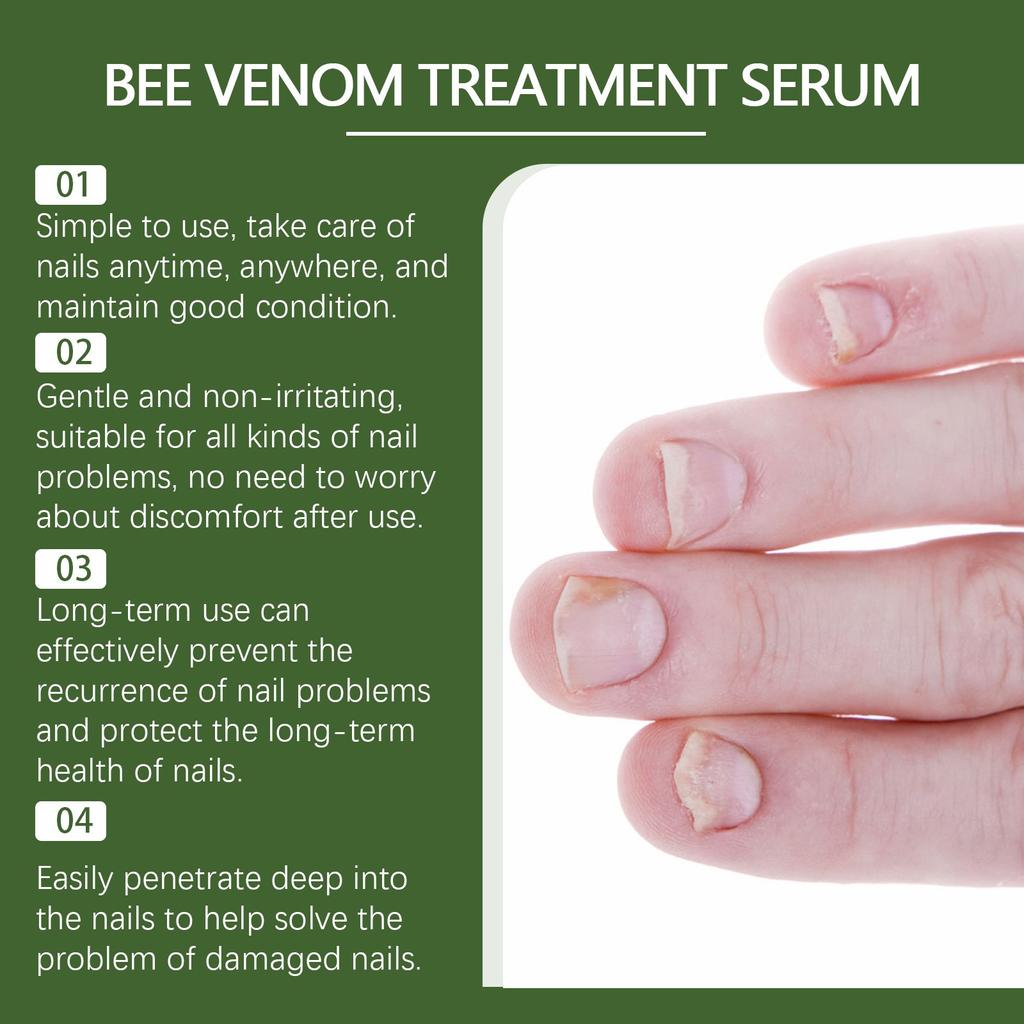 Nail Repairing Lotion Repairing Nails Care Hand Foot And Nails Nourishing Soft Nail Care 30ml