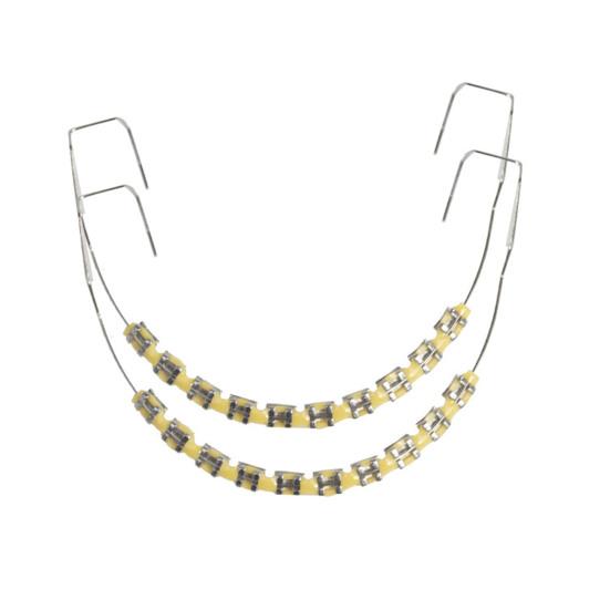 Temporary Tooth Decoration with Metal Wires Brackets Orthodontic Ligatures Orthodontists Explain Dental Students Practice Props