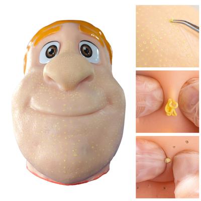Игрушка для снятия стресса Yousheng, лопание прыщей, с запасной головой манекена, лопание акне, очищающая игрушка-непоседа, симулятор лица, удаление черных точек на носу, сенсорная игрушка