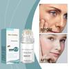 Micro Needle Firming Liquid Enhances Skin Firmness, Improves Texture, And Daily Skin Care Lotion,10ML