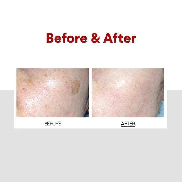 Крем MEDI-PEEL Melanon X 30 мл