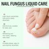 Nail Care Liquid, Soft And Bright Nails, Improve Ingrown Nails, Thickened Onychomycosis Nourishing Care Liquid 30ML