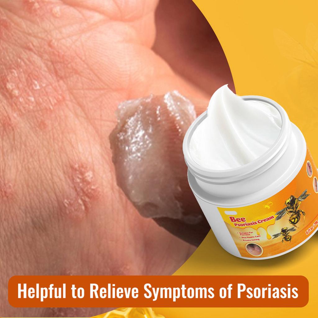 Пластырь Bee Series Крем от стригущего лишая на коровьей коже Крем для кожи Зудящий крем