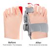 Bunion Corrector Adjustable Knob Big Toe Straightener Hallux Valgus Correction Hammer Toe Separator Orthopedic Bunion Splint Pain Relief Feet Brace
