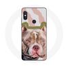 Case - Xiaomi - Redmi Note 5 Pro - Flexible - Pitbull Dog - Brown