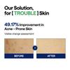 MEDIHEAL OFFICIAL Квадратные тонер-пэды для лица 100 Удаление несовершенств Корейская косметика (Чайное дерево) Простыни, 170 мл, Прокладки,