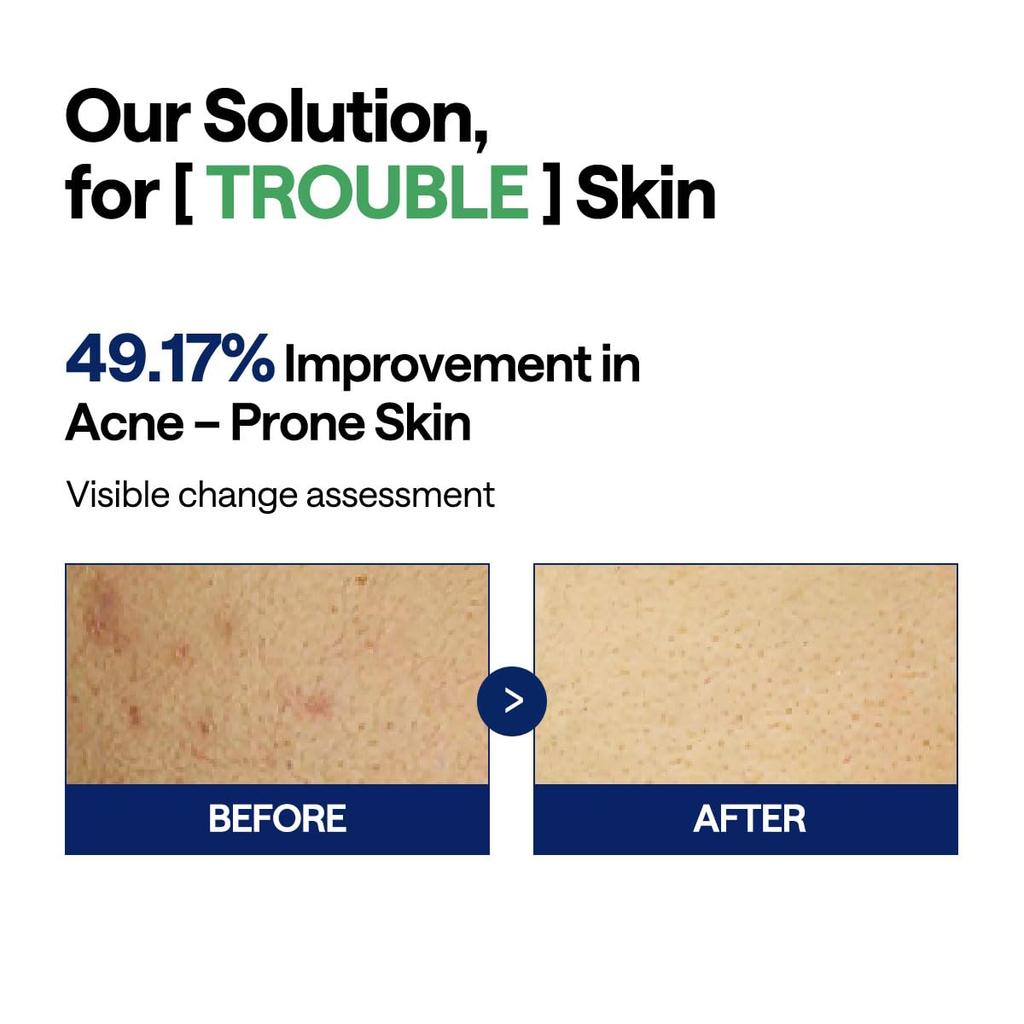 MEDIHEAL OFFICIAL Квадратные тонер-пэды для лица 100 Удаление несовершенств Корейская косметика (Чайное дерево) Простыни, 170 мл, Прокладки,