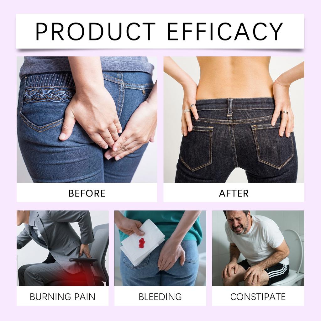 Юдаоплейсхолдер0 Гель Перианальный Успокаивающий Гель Гель от Геморроя Снимает Отек, Зуд и Дискомфорт,20г