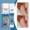 Varicose Vein Relief Cream Leg Massage Care Massage, Blue Veins And Red Blood Vessels Varicose Veins, Leg Fatigue And Soreness, Reduce Swelling A
