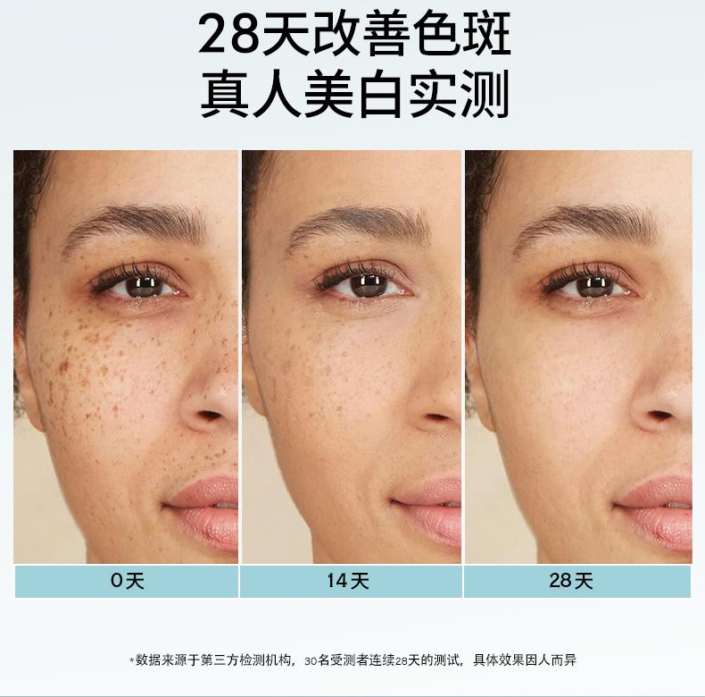 Niacinamide Whitening and Spot Removal Cream