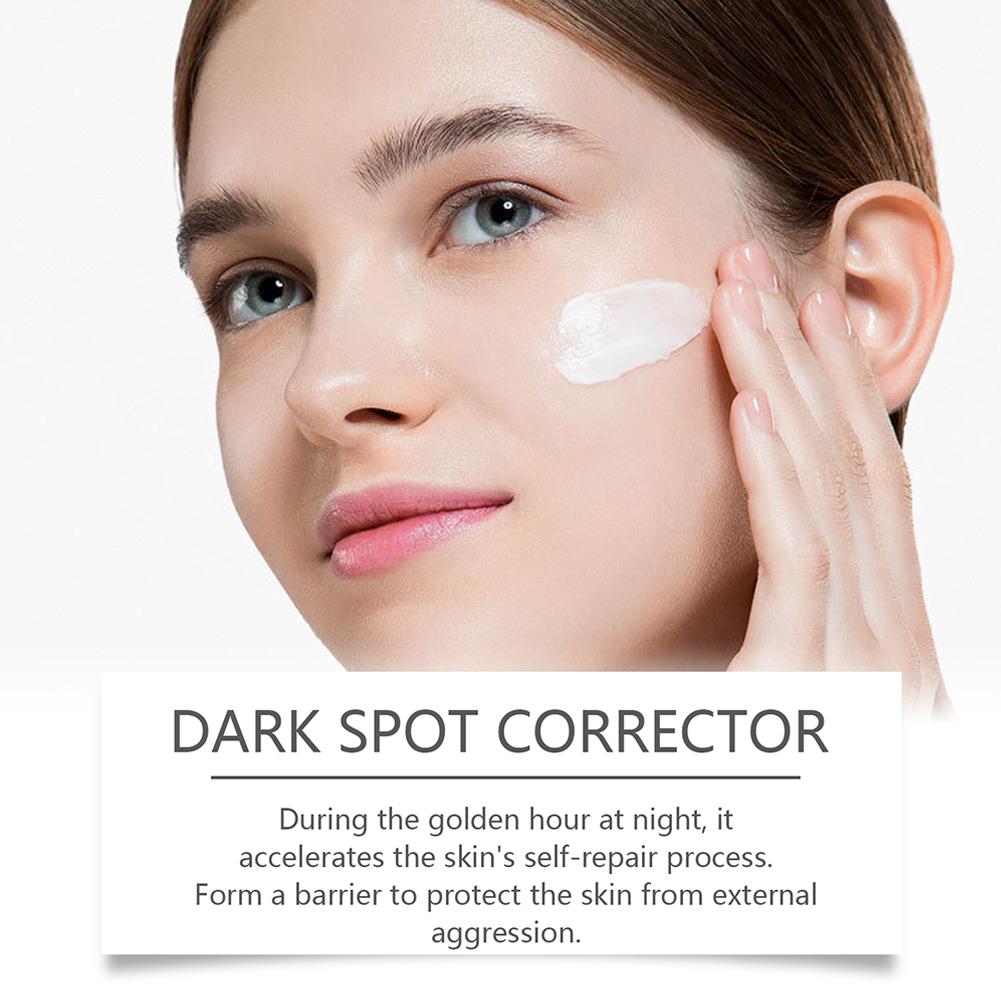Ретинол Отбеливающий крем от веснушек Осветление тона кожи Осветление Увлажнение Гиалуроновая кислота F I0X3