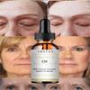 TCA Aid Skin Peel Трихлоруксусная кислота 20% Skin Peel Сокращение пор Морщины Пятна Уход за кожей Сыворотка для лица