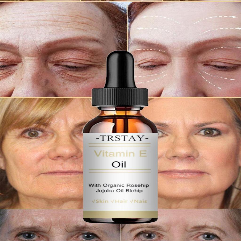 TCA Aid Skin Peel Трихлоруксусная кислота 20% Skin Peel Сокращение пор Морщины Пятна Уход за кожей Сыворотка для лица