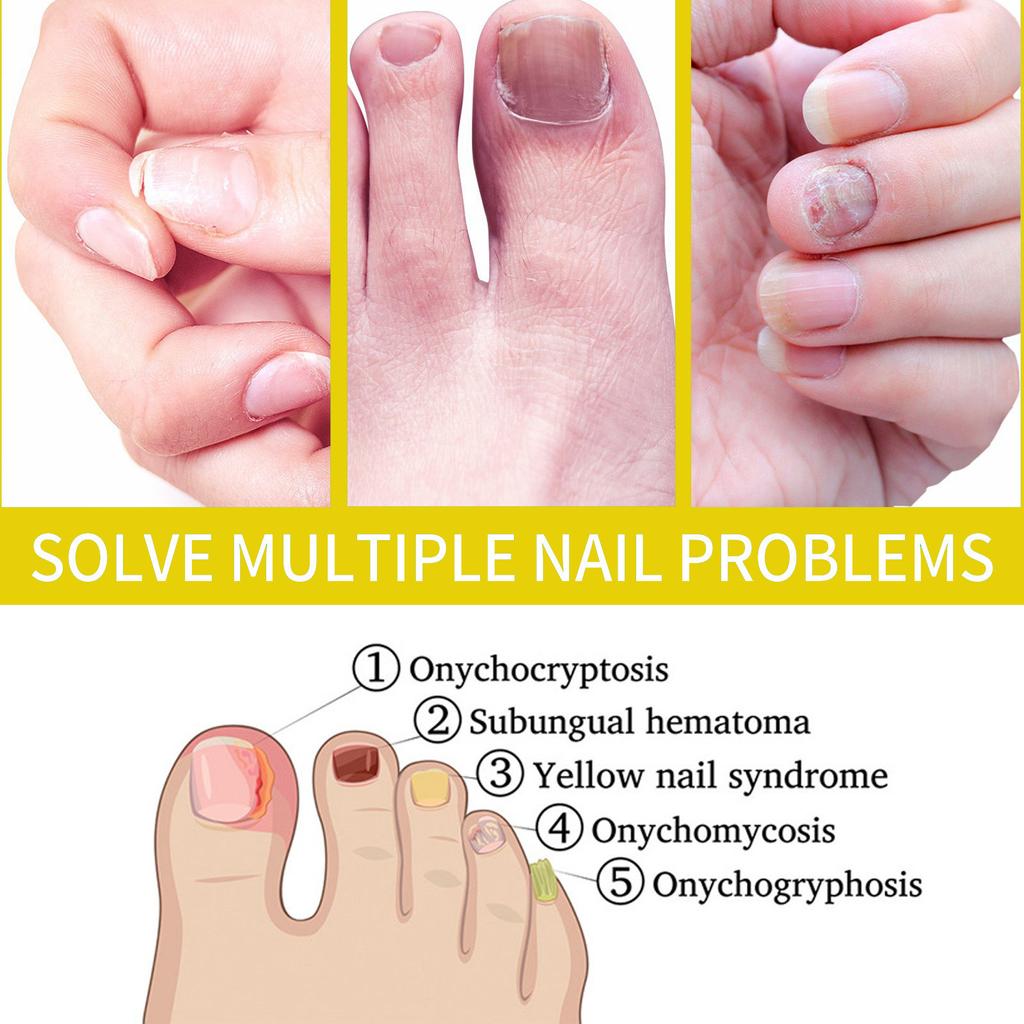 Масло для роста ногтей Rejuvenation, Косметика Масло для роста ногтей, Масло для роста и укрепления ногтей Rejuvenation, Косметика Масло для роста ногтей Rejuvenation 2 мл