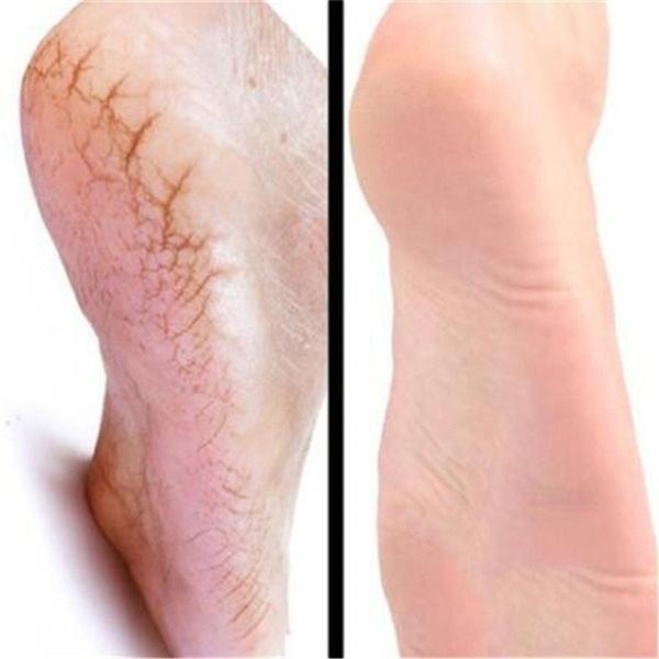 1 коробка конского масла, восстанавливающий крем для рук и ног, увлажняющий крем для ухода за кожей ног