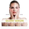 Limited time!!Hoygi Propolis Nicotinamide Essence Hydrates, Moisturizes, Whitens The Skin And Fades Facial Pigmentation And Fine Lines