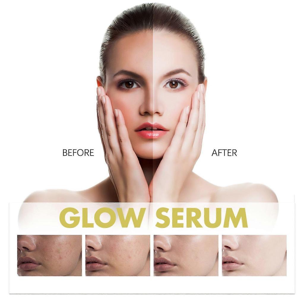 Limited time!!Hoygi Propolis Nicotinamide Essence Hydrates, Moisturizes, Whitens The Skin And Fades Facial Pigmentation And Fine Lines
