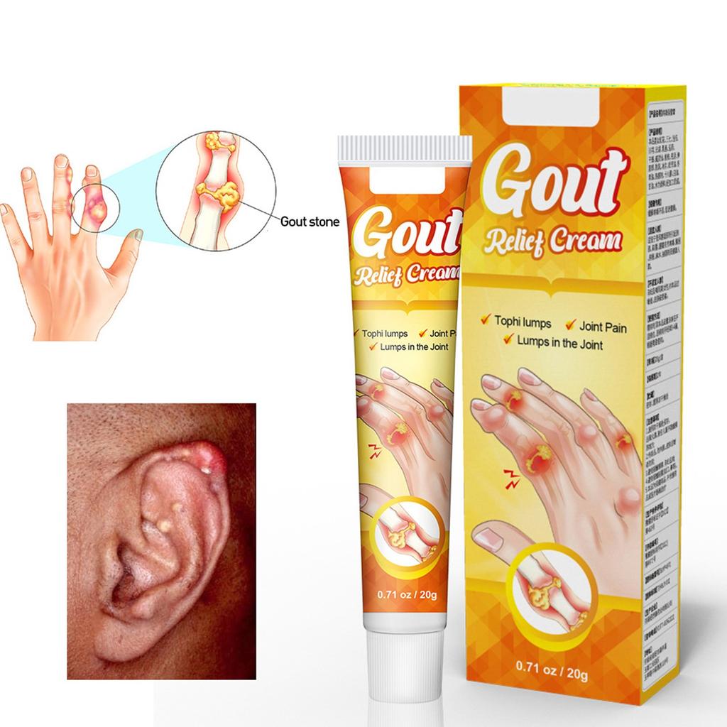 Крем для снятия боли, крем для снятия отечности суставов, крем для снятия отечности больших пальцев ног при подагре