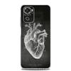 Чехол для телефона Chalkboard Anatomy для Xiaomi Redmi Note 13 12 5G 9S 9 8 10 11 Pro Plus 4G 9T 13C 12C10C 9C 9A 7 Прозрачная крышка