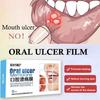 Патч для быстрого лечения язв во рту, повязка для ран полости рта при афтозном стоматите, быстрое облегчение боли, лекарство от афтозного стоматита, обезболивающее