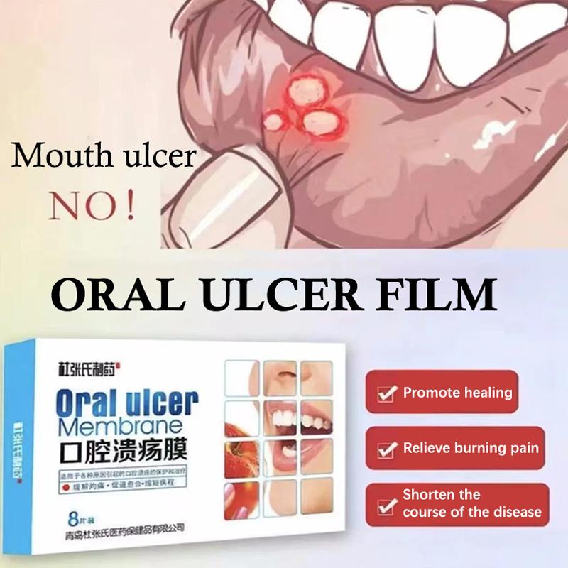 Патч для быстрого лечения язв во рту, повязка для ран полости рта при афтозном стоматите, быстрое облегчение боли, лекарство от афтозного стоматита, обезболивающее
