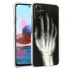 Прозрачный чехол для телефона для Redmi 14C 13C 10C 10 9 Note 13 12 11 K50 K40 Plus Pro 4G 5G Мягкий ТПУ чехол Осень Рентген Кости Руки