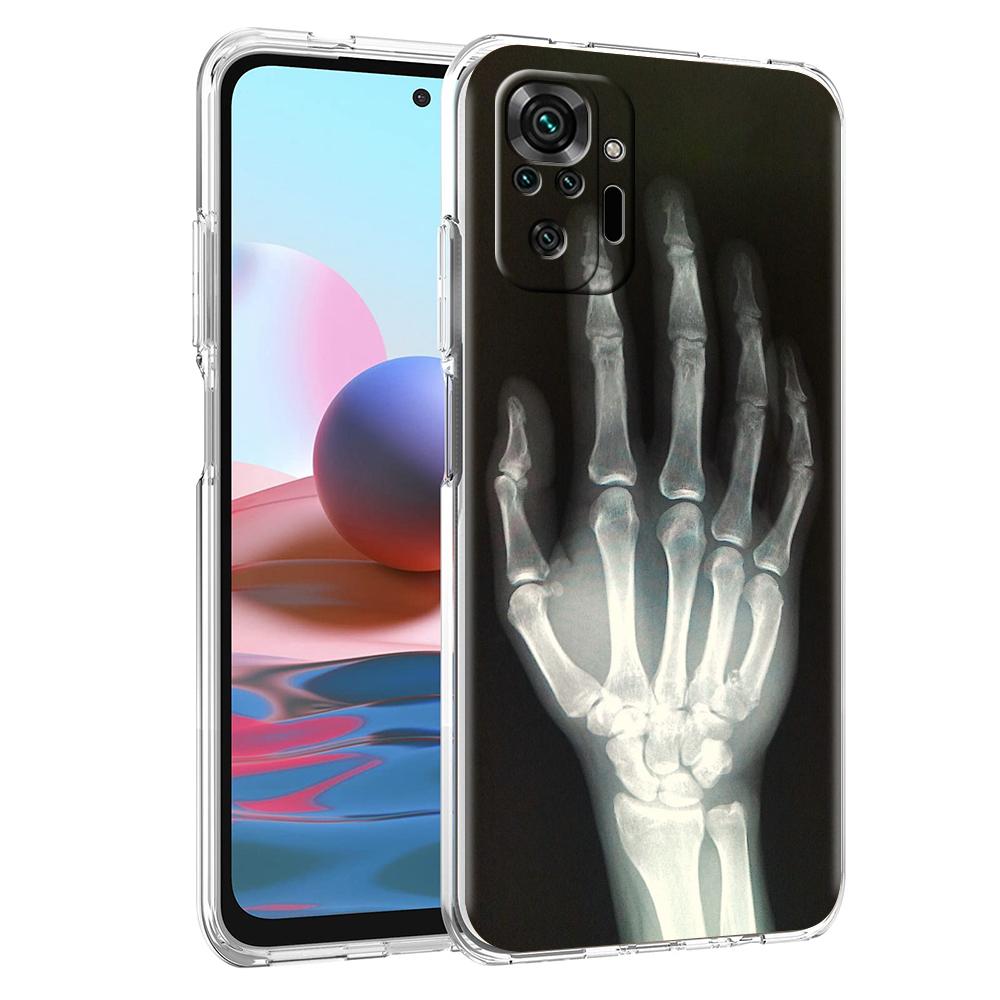 Прозрачный чехол для телефона для Redmi 14C 13C 10C 10 9 Note 13 12 11 K50 K40 Plus Pro 4G 5G Мягкий ТПУ чехол Осень Рентген Кости Руки
