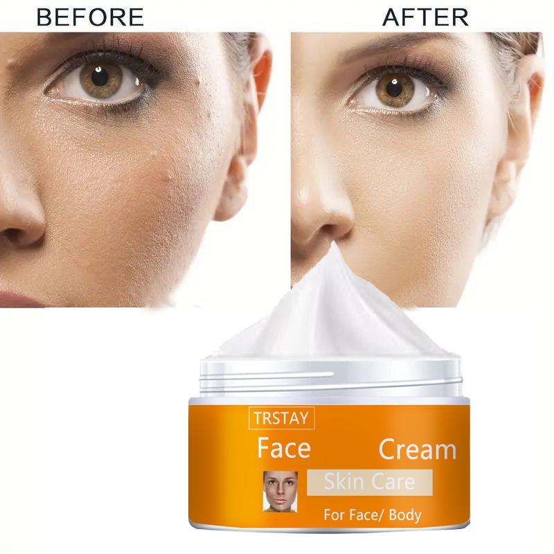 Увлажняющий крем восполняет запасы влаги, устраняет сухость, защищает кожу от повреждений, восстанавливает баланс воды и жира, делает кожу нежной и гладкой.