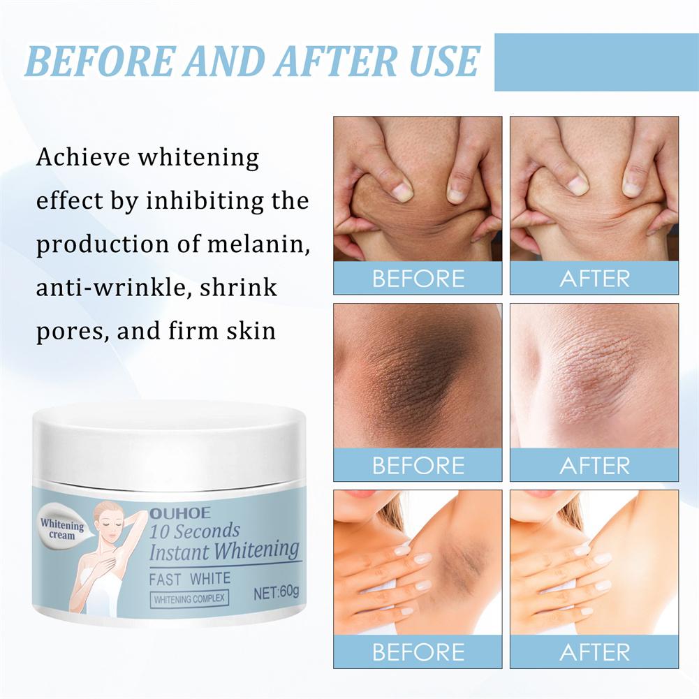 Intimate Area Whitening Cream Underarm Elbow Buttock Private Bleaching Remove Melanin Dull Moisturizing Brighten Body Skin Care