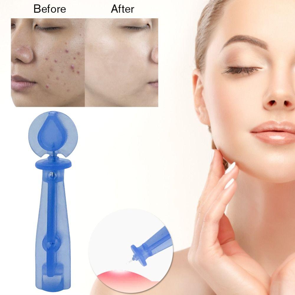 50Pcs/Box Skin Care Blackhead Remover Tool Professional Pimple Pins Home Use
