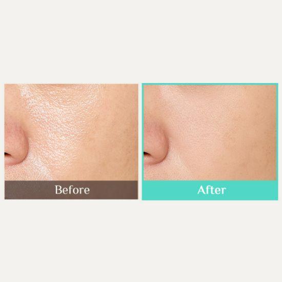 OBgE Pore Zero Oil Control Sun Stick SPF50+ PA++++ 18g