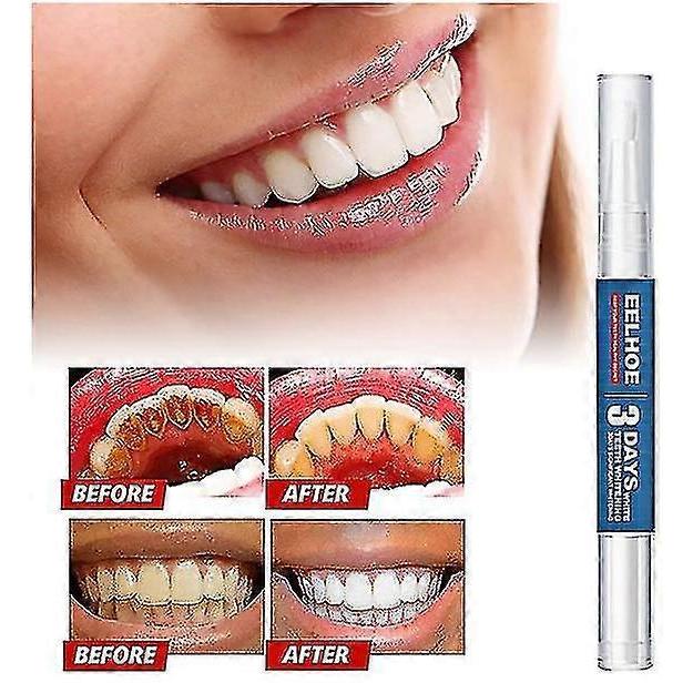 Teeth Tooth Whitening Gel Pen White Bleaching Dental Whitener White Teeth - CHUNC less