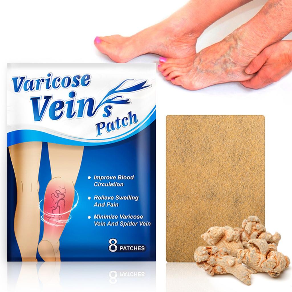 Пластырь от варикозного расширения вен, васкулит, флебит, сосудистый отек, лучшее средство, мазь, пластырь для ухода за кожей 8 шт.