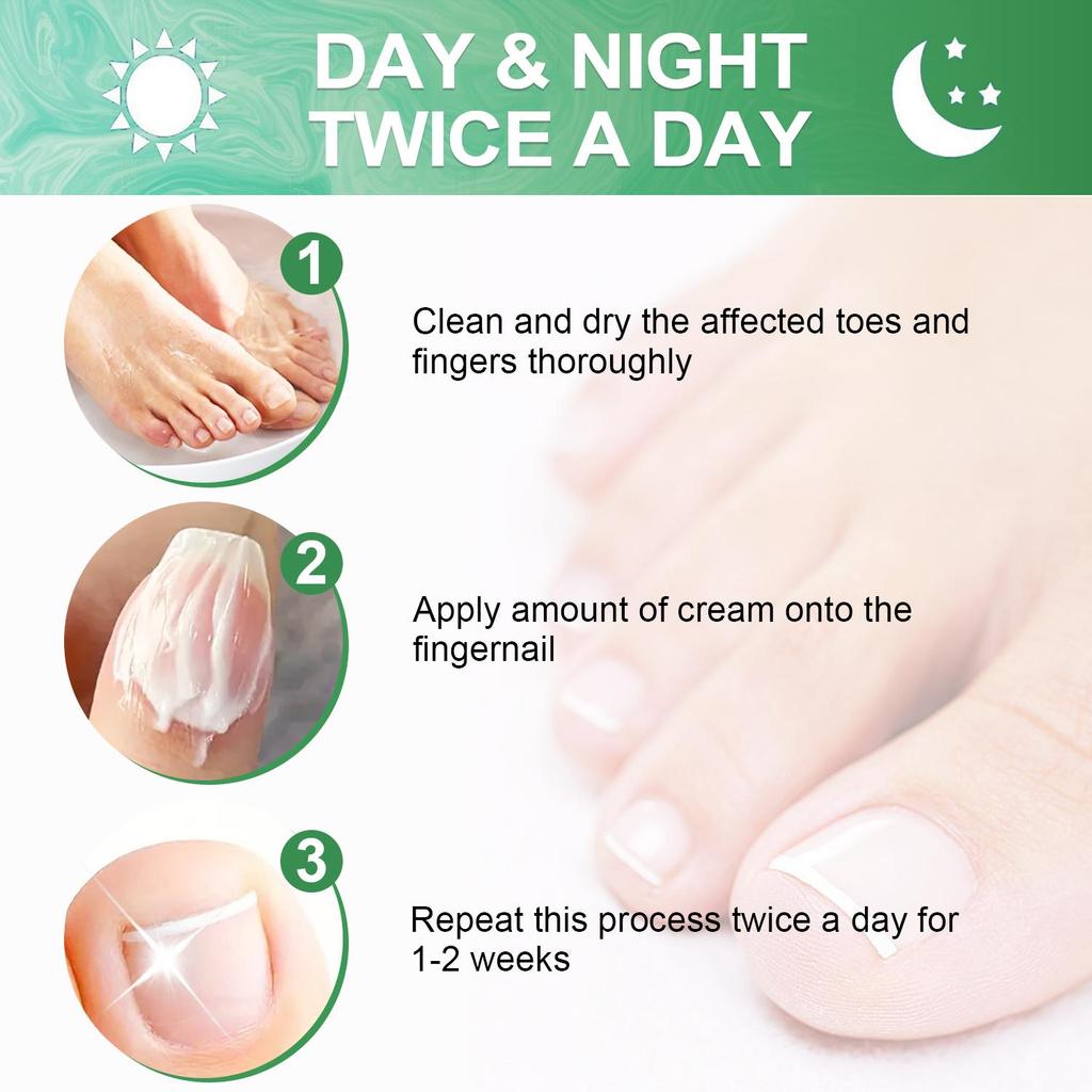 Крем для укрепления ногтей - Улучшает, обесцвеченные толстые ногти и Удаляет пятна с ногтей - СОЕВОЕ МАСЛО, КАСТОРОВОЕ МАСЛО, ПЧЕЛИНЫЙ ВОСК, ЛАВАНДА, ЛАНОЛИН, АЛОЭ ВЕРА - 100 г