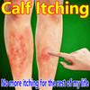 Anti-itch Cream for Calf Itching – Suitable for Persistent Calf Itching