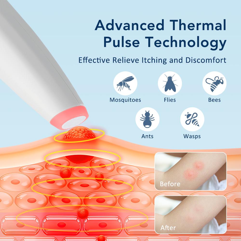 Electronic Mosquito Bite Anti-itch Device Physical Therapy 4 Gears Temperature Relieve Itching and Swelling Suitable for Outdoor
