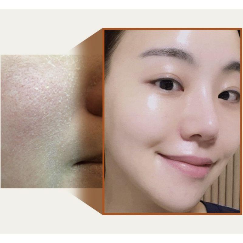 Mommy Care Herbal Job's Tears Texture Refining Cream 50g – Skin Smoothing Moisturizing Cream