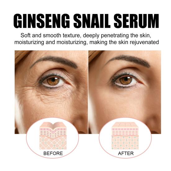 Ginseng Snail Anti-Aging Essence Осветляет тон кожи Осветляет мелкие морщинки Восстанавливающая сыворотка для веснушек Сужает поры Подтягивающая укрепляющая эссенция Средство по уходу за кожей