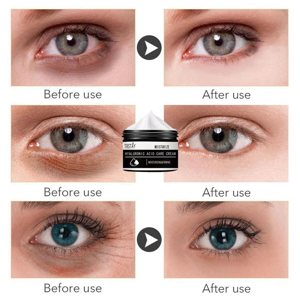 Увлажняющий крем для кожи вокруг глаз мягко, не раздражает и разглаживает морщины, уменьшает мелкие морщинки, смягчает и улучшает состояние поврежденной кожи.