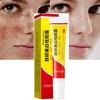Whitening Freckle Cream Remove Acne Spot Pigment Melanin Dark Spots Pigmentation Moisturizing Whitening Cream