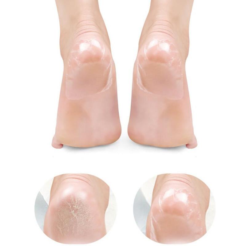 Увлажняющие патчи для ног, против трещин, для удаления мозолей сухой кожи