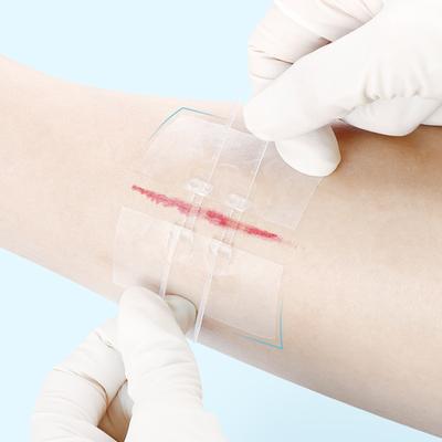 1/2 шт. Пластырь для закрытия ран на молнии, Гемостатический пластырь, Быстрое заживление ран, Пластырь на молнии, Портативный для улицы