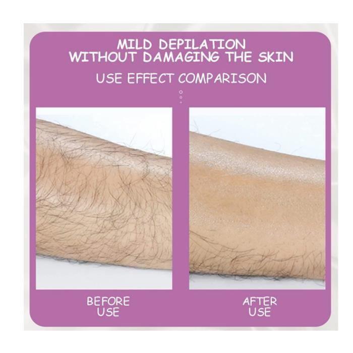 Épilateur D'épilation Physique Indolore Pour Femme épilateur Cristal Gomme à Cheveux en Crystal,Épilation sans Rasage Douleur(Or)