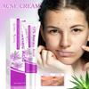 12% Acne Cream Azelaic Acne Cream, Acne Cream That Reduces Pimples And Closed Mouths For Smooth, Even Skin Tone,20g