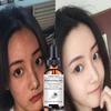 New Formula Essence To Fade Dark Spots Vitamin C Facial Essence Brightening Facial Essence