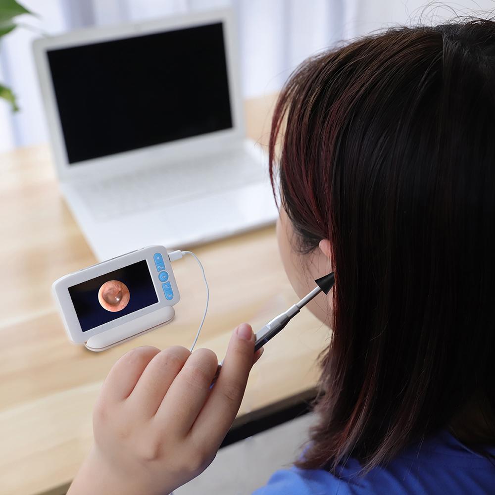 Цифровой отоскоп с 6 светодиодами, 32G TFcard, 3,9 мм, 1080P, камера для наблюдения за ушами, 4,3 дюйма