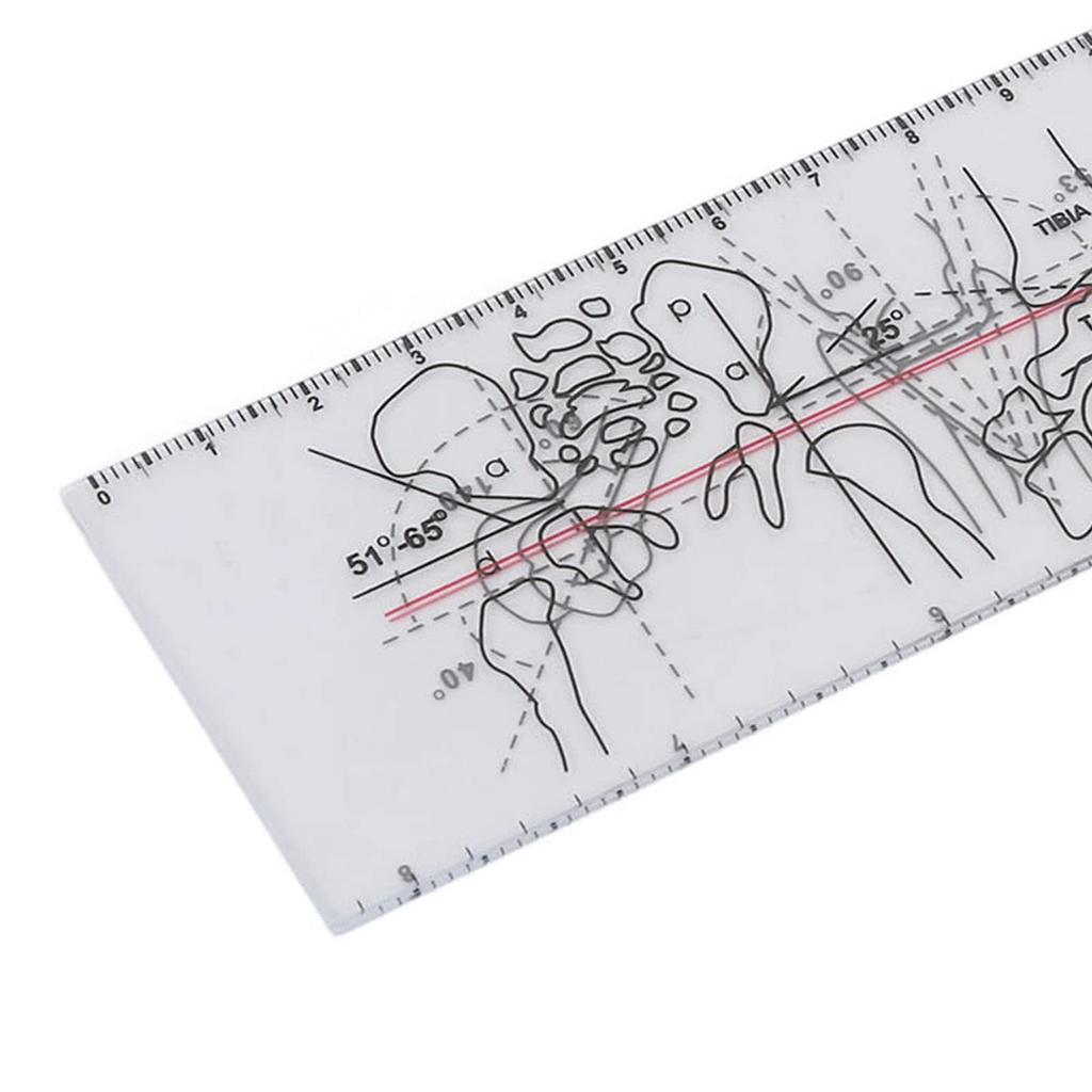 Ортопедическая линейка, многофункциональная печать среднего слоя, прочный спинальный гониометр для оценки реабилитации