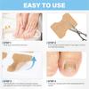 Ingrown Toenail Corrector Stickers, Ingrown Toenail Tool Pieces Ingrown Toenail Lifter and File Nail Patches For Ingrown Toenail