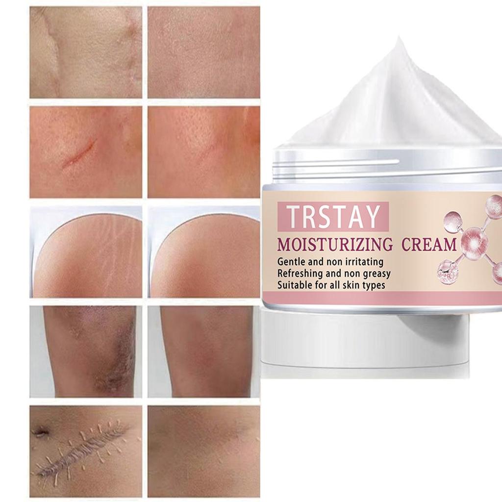 Сыворотка для удаления шрамов от прыщей, масло, эфирные масла, эссенция, гель, лечение растяжек, прыщи, пятна от прыщей, хирургические шрамы, ожоги