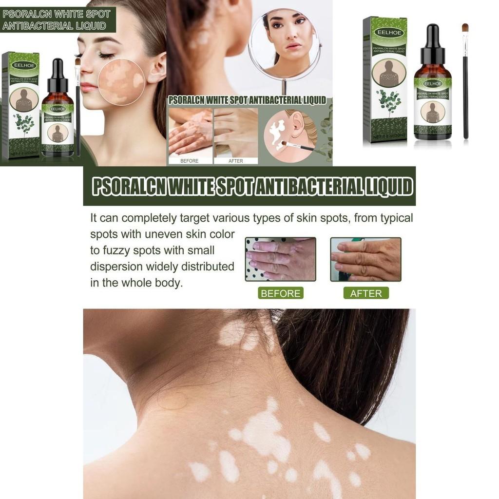 Eelhoe White Spot Repair Serum For Skin Brightening Moisturizing And Nourishing Care